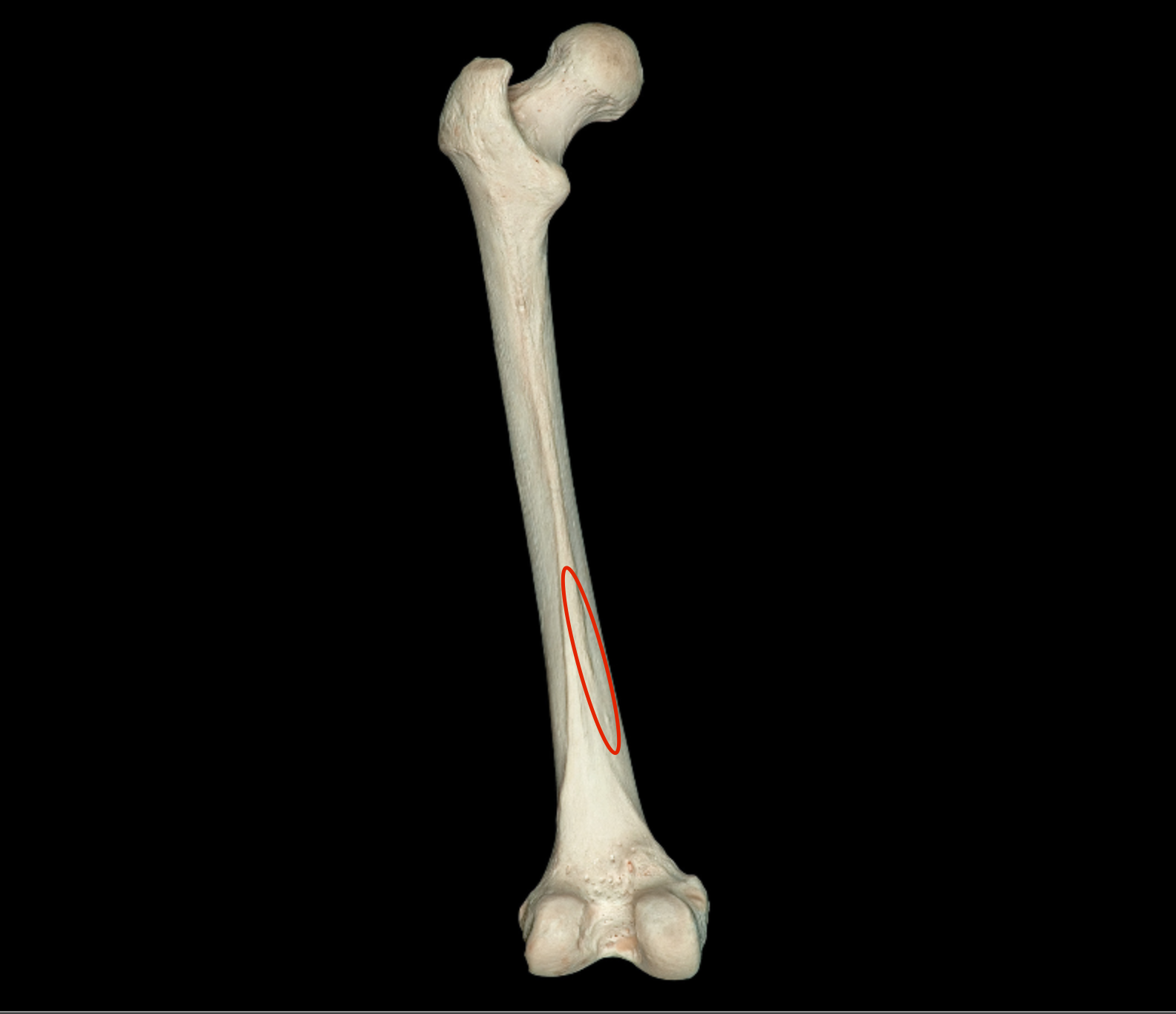 <p>medial edge of “posterior border” of femur</p>
