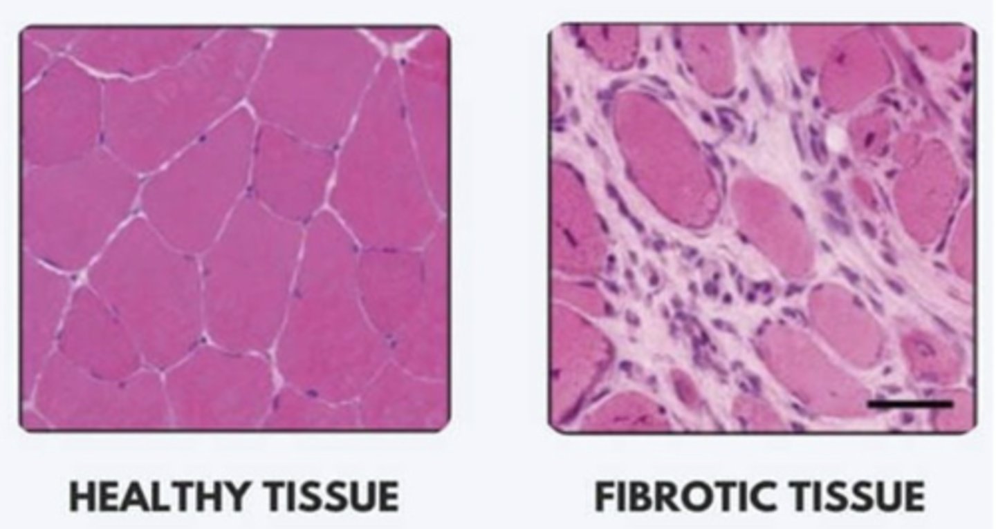 <p>- Soft/Supple</p><p>- Flexible</p><p>- Highly functional</p><p>- Decreased joint load</p>