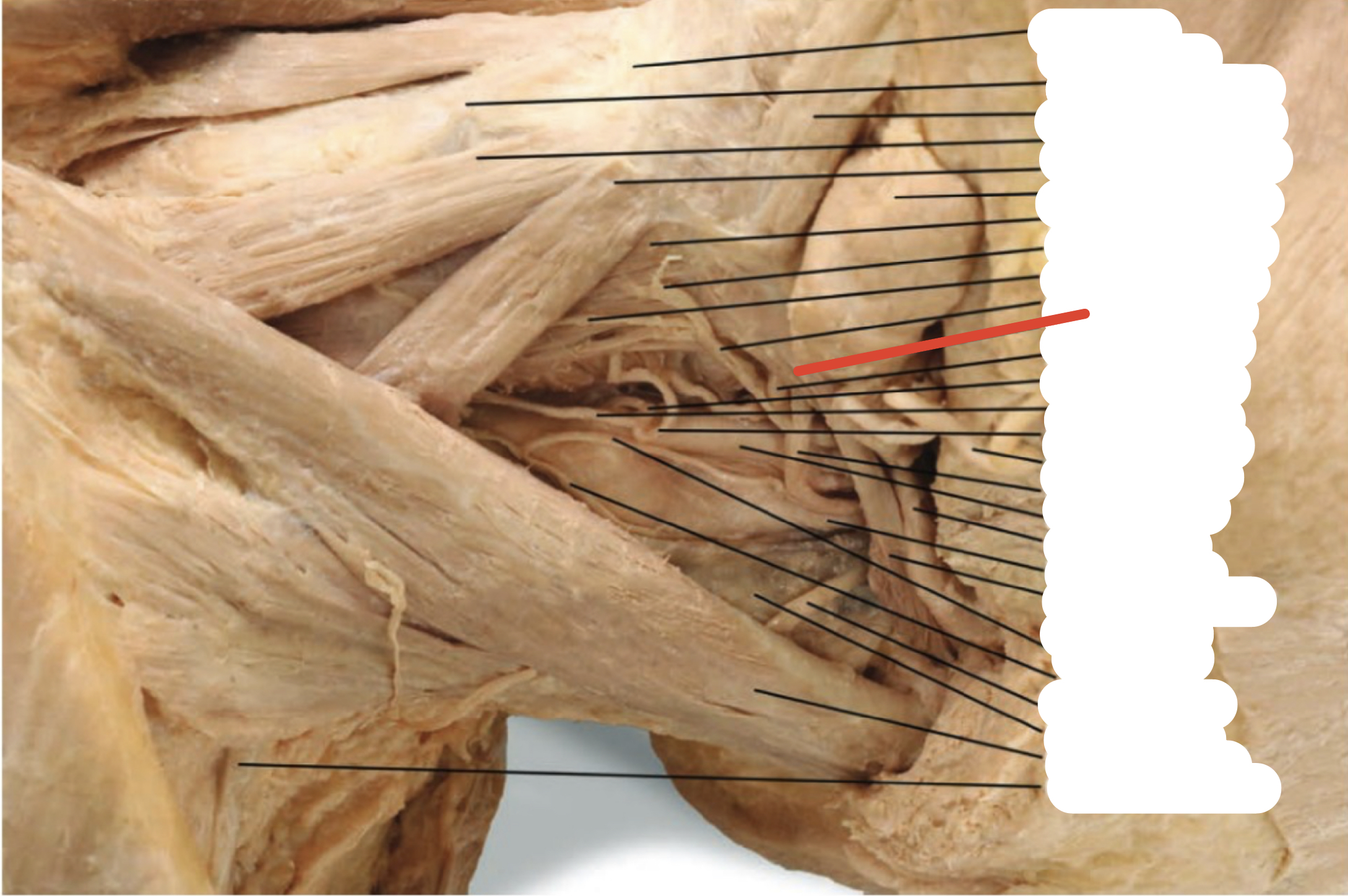 Identify the structure (red line)