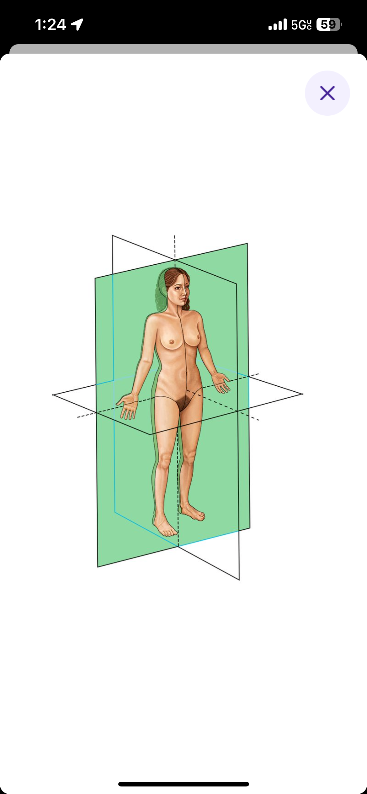 <p>Vertical plane that divides the body anterior (front) and posterior (back) sections </p>
