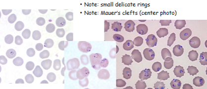 <p>What is the genus, species, and stage of this parasite?</p>