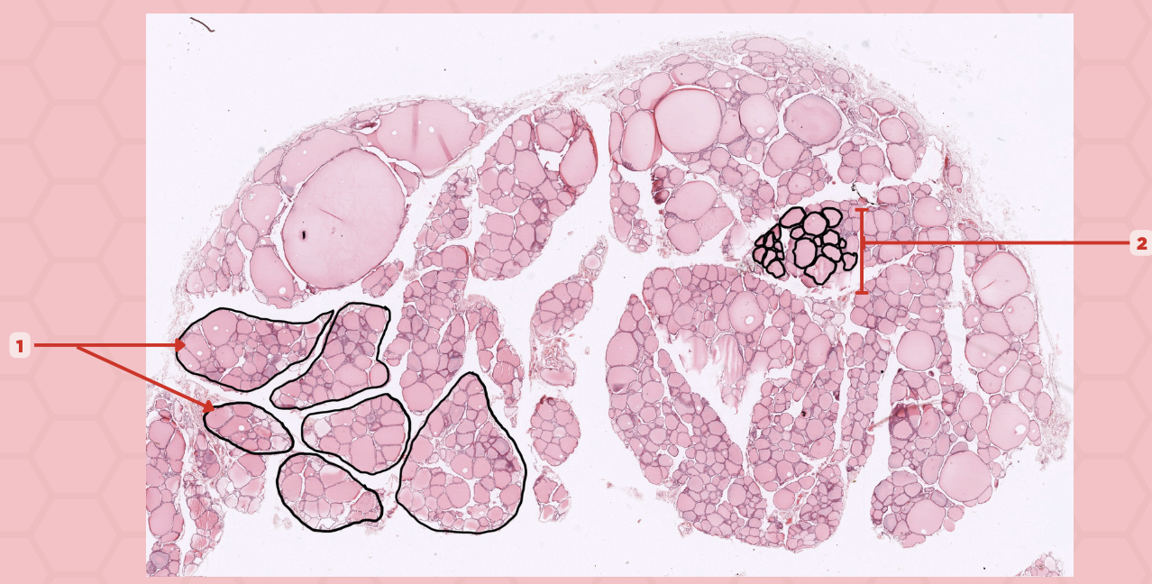 <p>Identify the structure labeled as 1.</p>