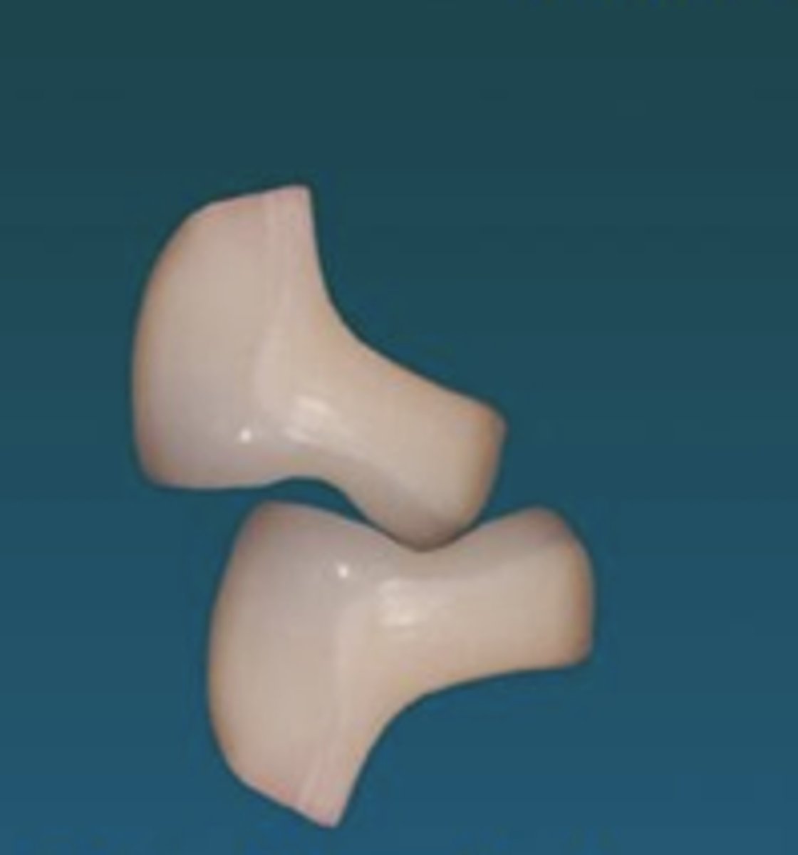 <p>1. supporting cusps to marginal ridges</p><p>2. supporting cusps to fossa</p>