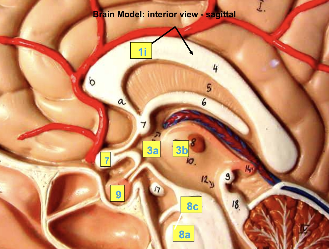 <p>3b</p>