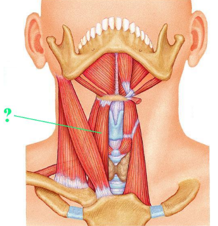 <p><span>Identify the indicated muscle.</span></p>