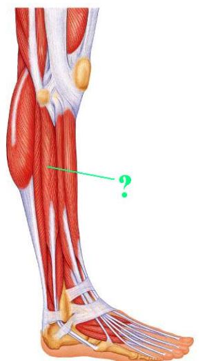 <p><span>Identify the indicated muscle.</span></p>