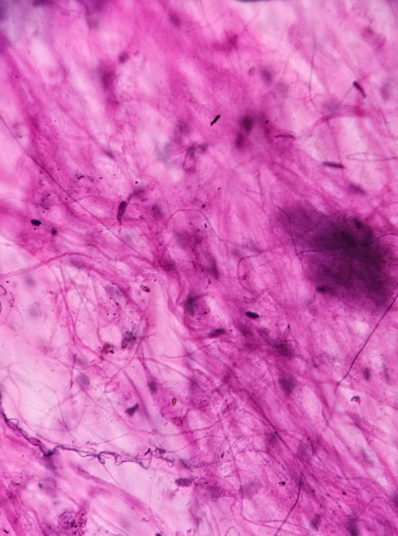 <p>stringy fibers </p><ul><li><p>dark think “strings” = elastic fibers</p></li><li><p>thick lighter “strings” = collagen fibers </p></li></ul><p></p>