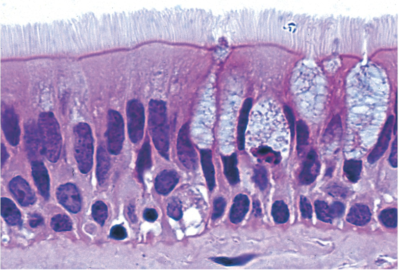 <p>Ciliated pseudostratified columnar epithelium</p>