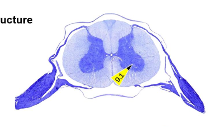 <p>What microscopic structures are found at the tagged location</p>
