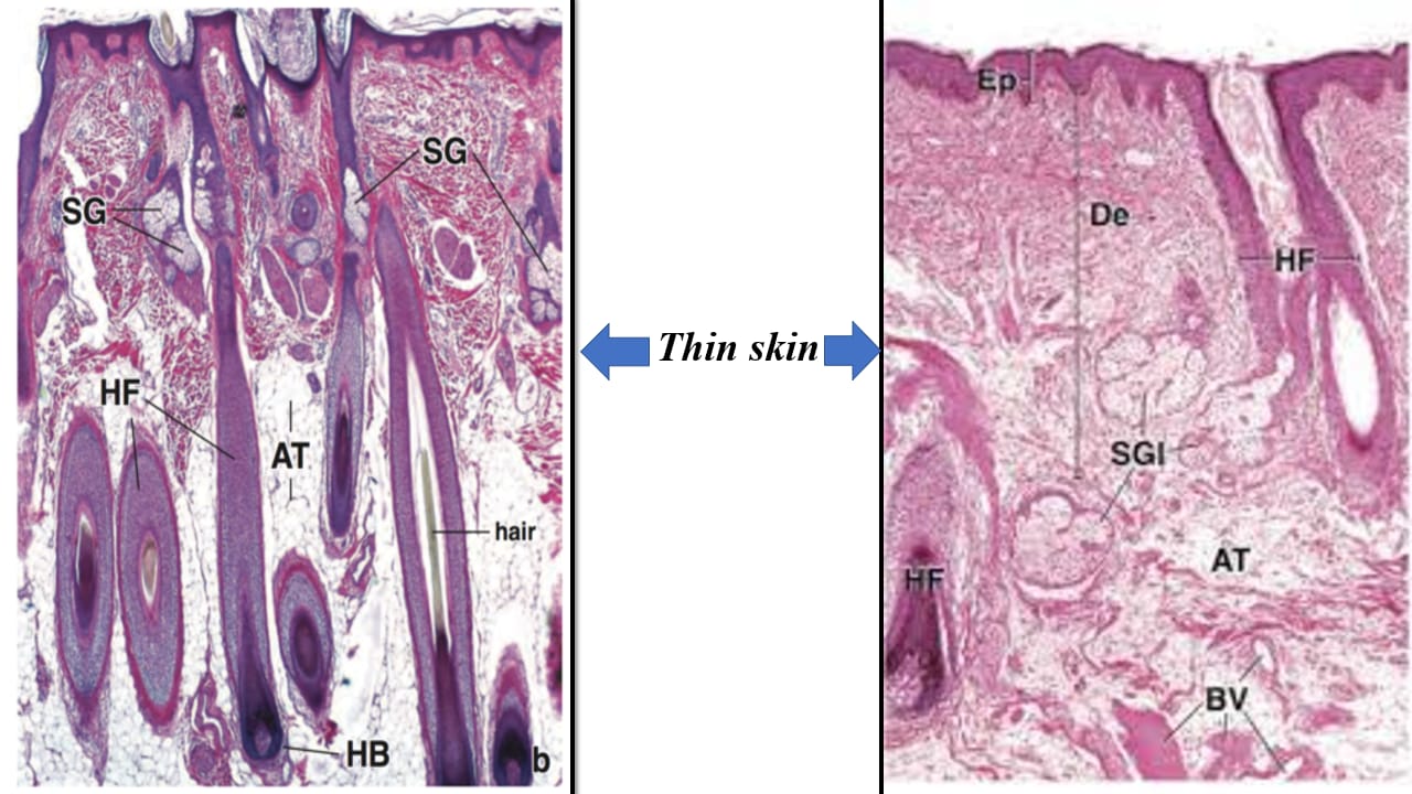 <p>Thin skin v.s thick skin – LM</p>