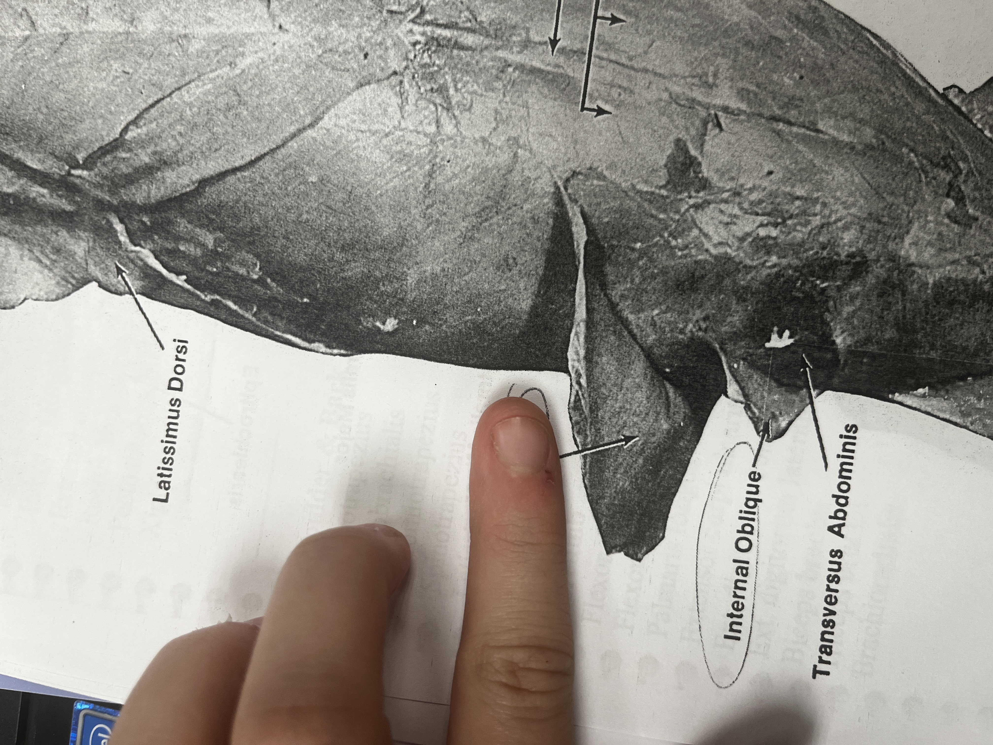 <p>The outermost layer of the abdominal muscles, aiding in trunk rotation.</p>