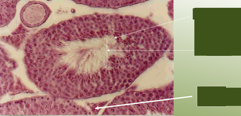 <p>label the structures of the testis under a microscope.</p>