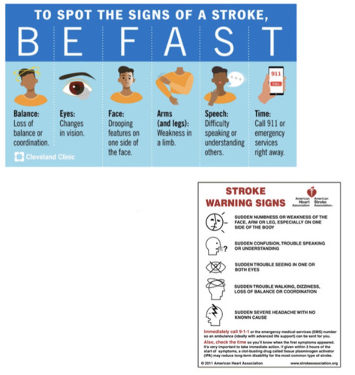 <p>-there are 2 main mechanisms of stroke</p><p>o ischemic: result of a thrombus, embolism or low systemic perfusion</p><p>o hemorrhagic: abnormal bleeding into the brain</p><p>-s/s</p><p>o sudden severe headaches</p><p>o sudden weakness of the face, arm or leg, especially ONE SIDED</p><p>o loss of speech</p><p>o changes in vision</p><p>o unexplained balance and coordination issues</p><p>-specific to women</p><p>o sudden hiccups that won't go away</p><p>o N/V</p><p>o SOB</p><p>o hallucinations</p><p>IF SUSPECTED, CALL 911 OR TAKE PT TO ER IMMEDIATELY!!</p>