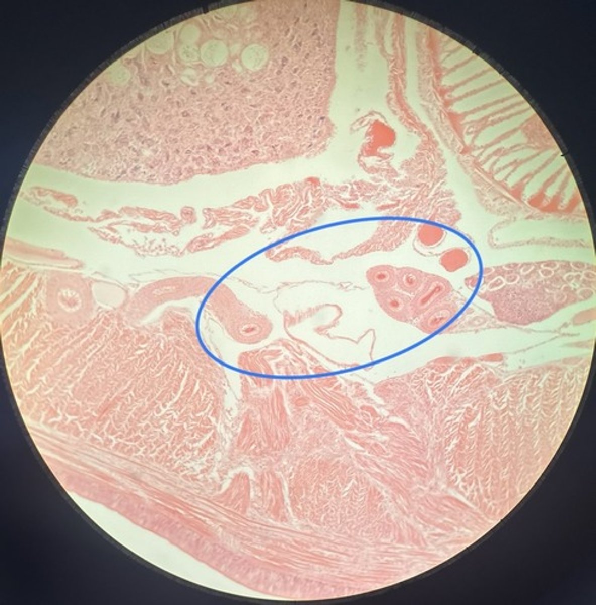 <p>What is the circled structure? What organism is this found in?</p>