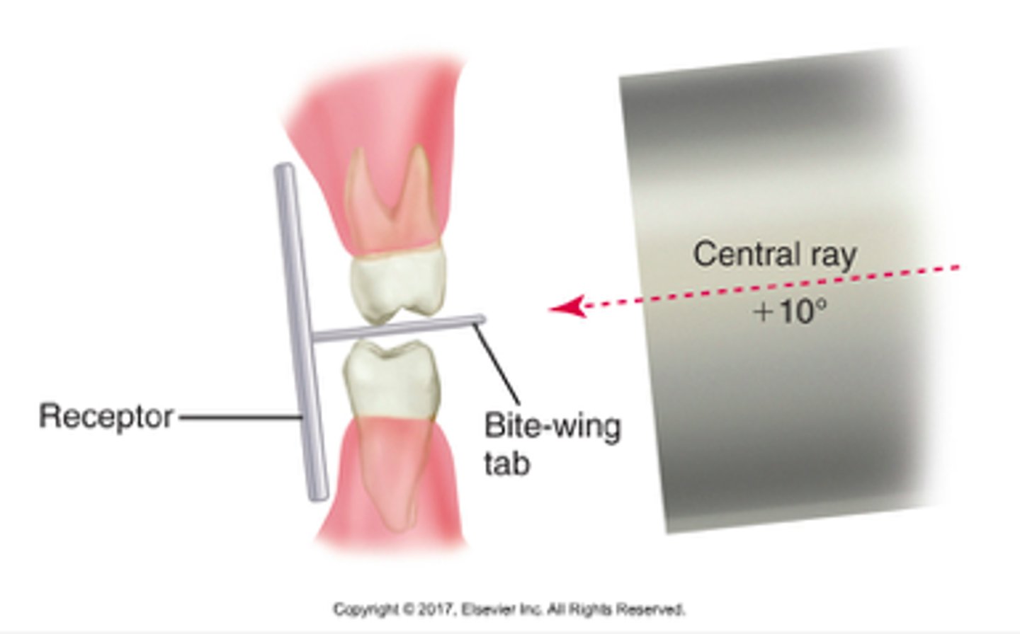 <p>1. receptor placed in mouth parallel to the crowns of both the max and mand teeth</p><p>2. receptor stabilized when pt bites on bite wing tab or beam alignment device</p><p>3. when using bitewing tab, central ray is directed through contacts of teeth and vertical angulation of +10 degrees</p>