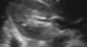 <p>What section of the kidney is this and which scan plane?</p>