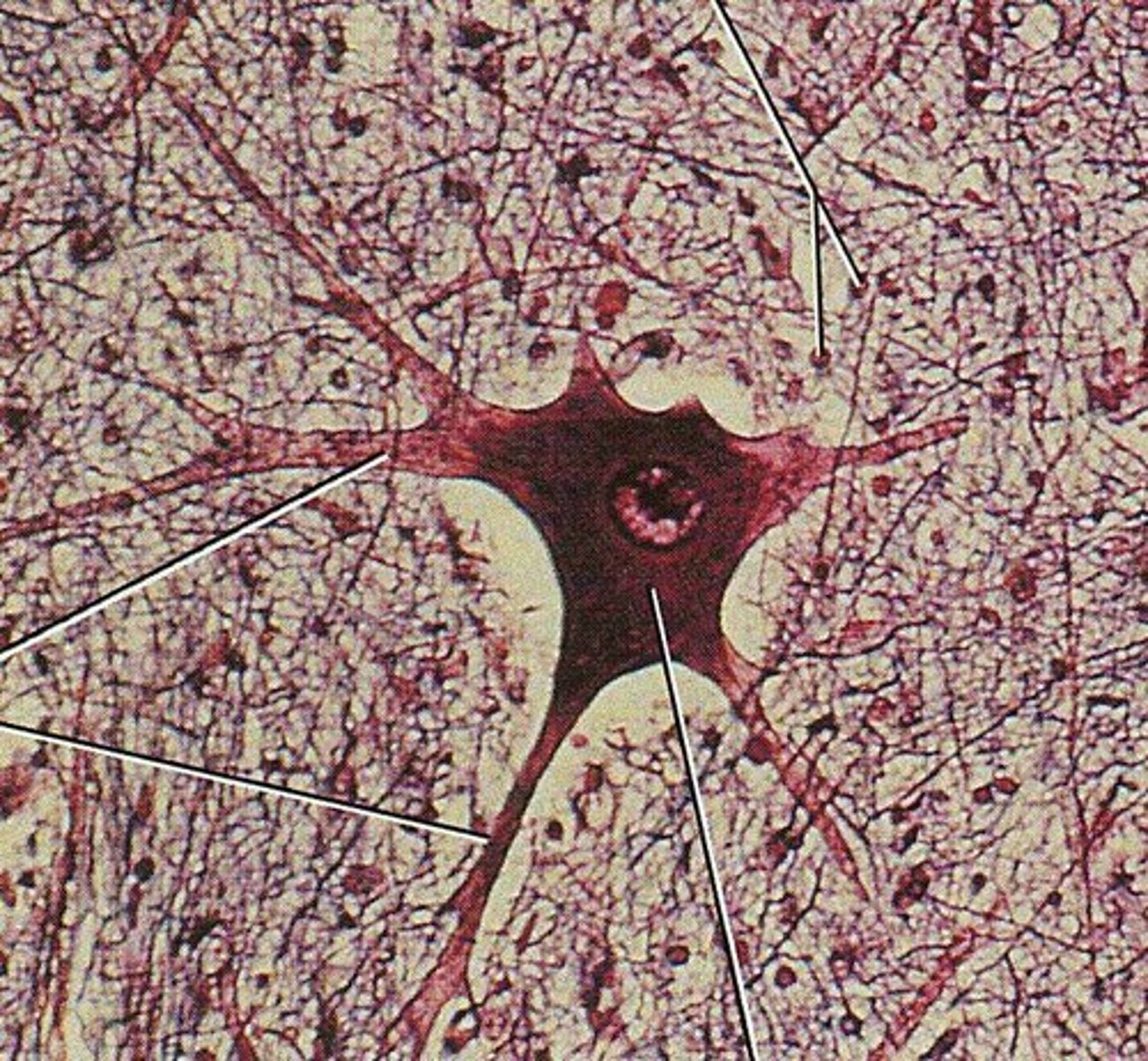 <p>It consists of a cell body, dendrites, and an axon.</p>
