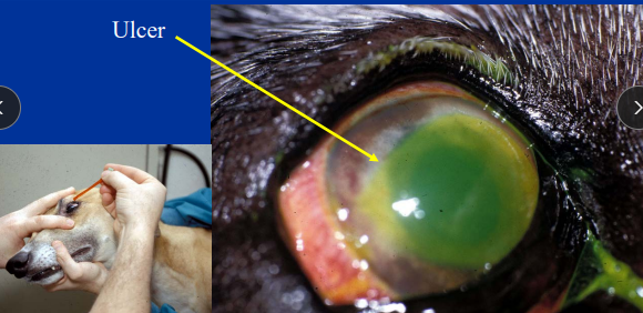 <ul><li><p><span style="background-color: transparent;"><strong><u><span>Cornea Epithelium “english muffin” non-keratinized!</span></u></strong></span></p><ul><li><p><span style="background-color: transparent;"><strong><span>Fxn: </span></strong></span><span style="background-color: transparent; color: red;"><span>mechanical barrier to imbibition of fluid by the stroma</span></span></p></li><li><p><span style="background-color: transparent;"><strong><span>Anatomy: </span></strong></span><span style="background-color: transparent; color: red;"><span>Anchoring fibrils</span></span><span style="background-color: transparent;"><span> for attachment</span></span></p><ul><li><p><span style="background-color: transparent;"><span> </span><strong><u><span>lipophilic: fluorescein not absorbed</span></u></strong></span></p></li></ul></li><li><p><span style="background-color: transparent;"><strong><span>Healing: </span></strong></span></p><ul><li><p><span style="background-color: transparent; color: red;"><strong><span>Cell turnover 7 days, ulcers should heal 48-72h hours!!</span></strong></span></p></li><li><p><span style="background-color: transparent; color: red;"><span>Damage = </span><strong><span>focal stromal edema in area of the ulcer</span></strong></span></p></li></ul></li></ul></li><li><p><span style="background-color: transparent;"><strong><u><span>Stroma “dry sponge” No blood vessels</span></u></strong></span></p><ul><li><p><span style="background-color: transparent;"><strong><span>Anatomy:</span></strong><span> 90% of total corneal thickness, </span><strong><span>Hydrophilic = absorbs stain/fluid if there is break in epithelium</span></strong><span>, </span></span></p></li><li><p><span style="background-color: transparent; color: red;"><strong><span>CN V trigeminal for outer 3rd innervation - superficial ulcers are more painful then deep ones</span></strong></span></p><ul><li><p>Diffuse edema can look blue and cloudy</p></li></ul></li></ul></li><li><p><span style="background-color: transparent;"><strong><u><span>Descemet’s membrane</span></u></strong></span></p><ul><li><p><span style="background-color: transparent;"><strong><span>Fxn: </span></strong><span>BM of </span><u><span>endothelium</span></u></span></p></li><li><p><span style="background-color: transparent;"><strong><span>Anatomy: </span><u><span>Does not retain fluorescein</span></u></strong><span>, Elastic</span></span></p><ul><li><p>rim of ulcer will stain but not the center - almost rupture: <strong>Emergency</strong></p></li></ul></li></ul></li><li><p><span style="background-color: transparent;"><strong><u><span>Endothelium: no blood vessels, NO undergo mitosis!</span></u></strong></span></p><ul><li><p><span style="background-color: transparent;"><strong><span>Fxn: </span></strong></span><span style="background-color: transparent; color: red;"><strong><span>physical barrier and metabolic pump to prevent stromal edema</span></strong></span><span style="background-color: transparent;"><span><br></span><strong><span>Healing: cellular enlargement and migration, no regeneration, </span><u><span>lose with age!!</span></u></strong></span></p><ul><li><p><span style="background-color: transparent;"><u><span>Damage = </span></u><strong><u><span>diffuse edema(blue eyes)</span></u></strong></span></p></li><li><p><span style="background-color: transparent;"><u><span>Look like honeycombs</span></u></span></p></li></ul></li></ul></li></ul><img src="https://knowt-user-attachments.s3.amazonaws.com/015a2440-9af1-484a-8654-e1ae6ba7b8ec.png" data-width="25%" data-align="center"><p></p>