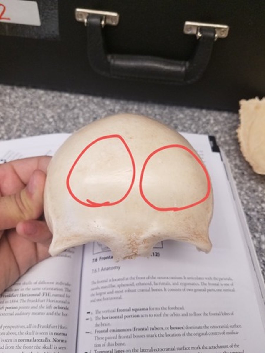 <p>What feature is this on frontal bone (Ectocranial)</p>