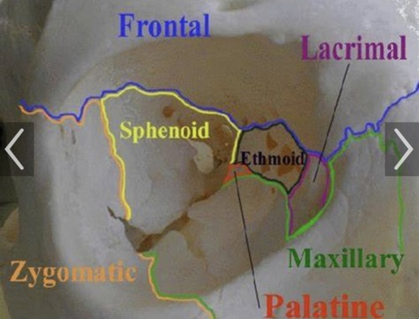 <p>1. Frontal</p><p>2. Maxillary</p><p>3. Zygomatic</p><p>4. Ethmoid</p><p>5. Sphenoid</p><p>6. Palatine</p><p>7. Lacrimal</p>