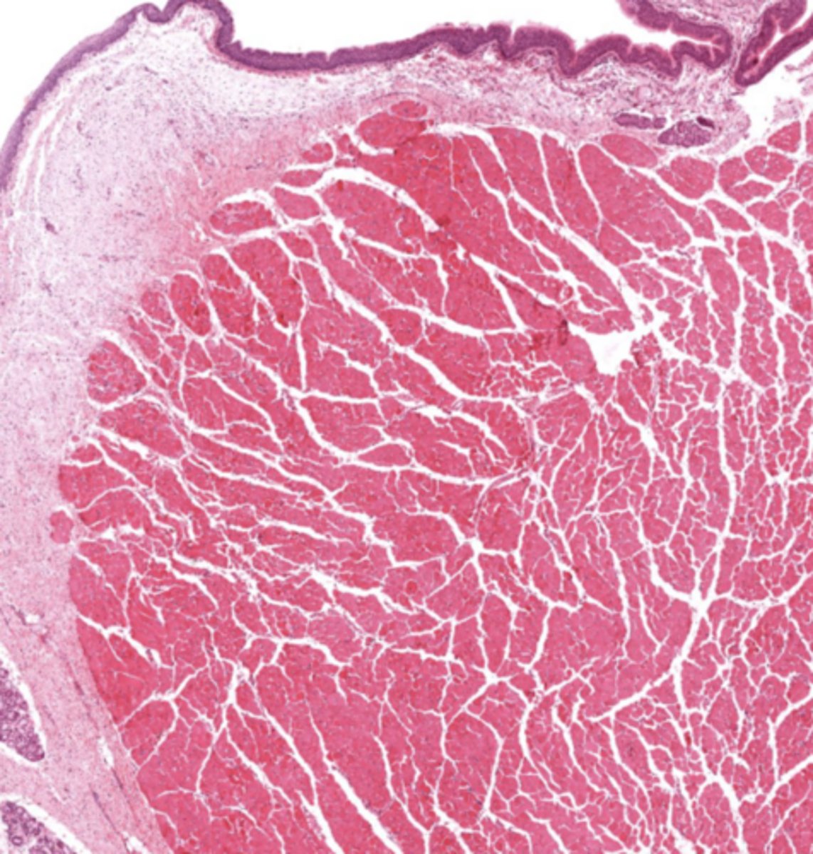 <p>Vocalis muscle (skeletal muscle).</p>