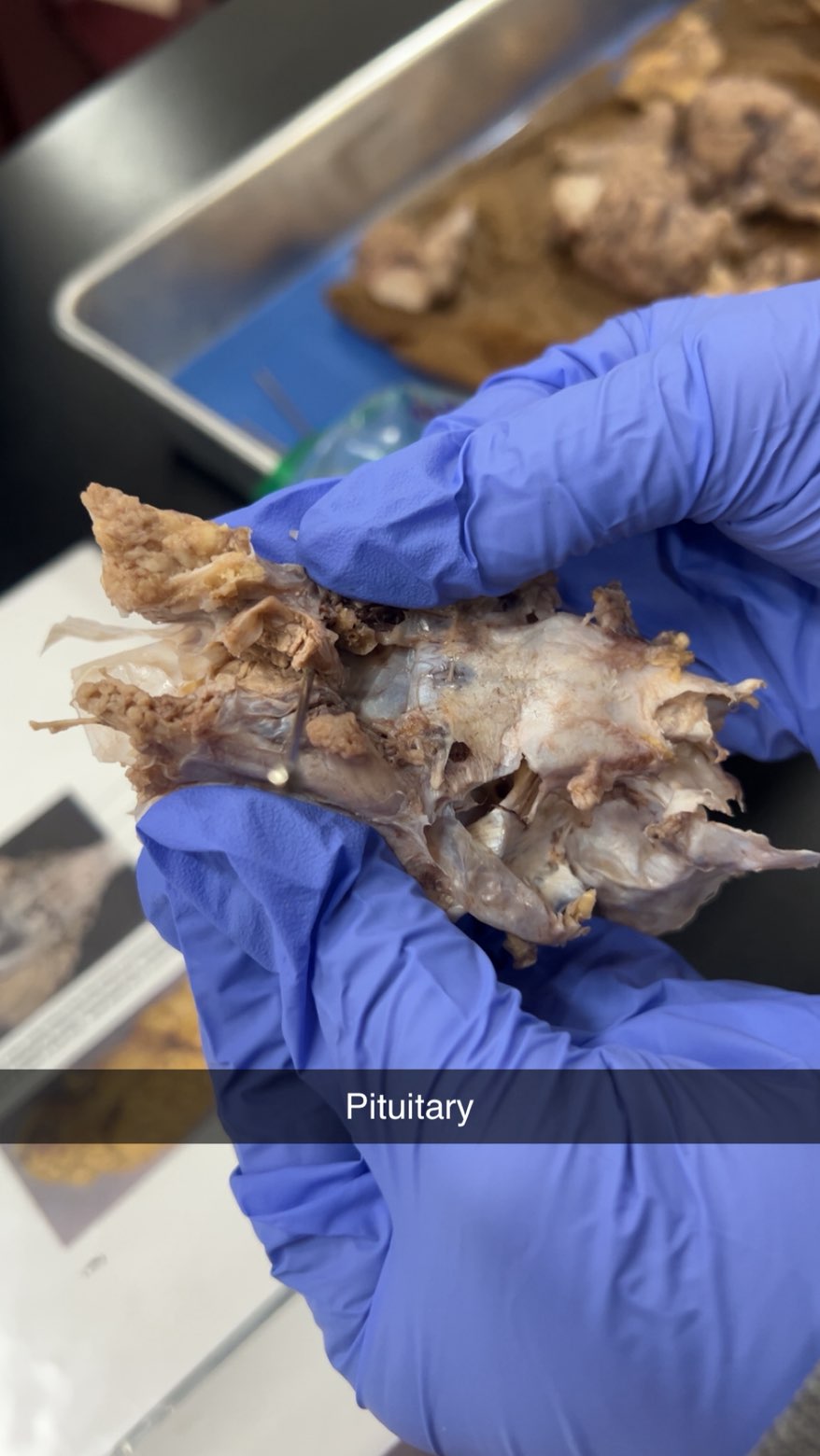 <p>pituitary gland</p>