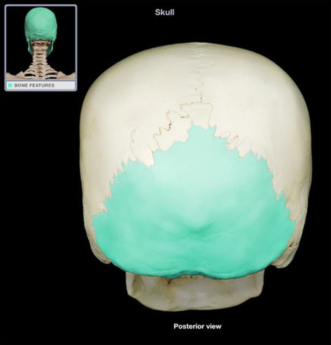 <p>Bone that forms the posterior and base of the cranium</p>