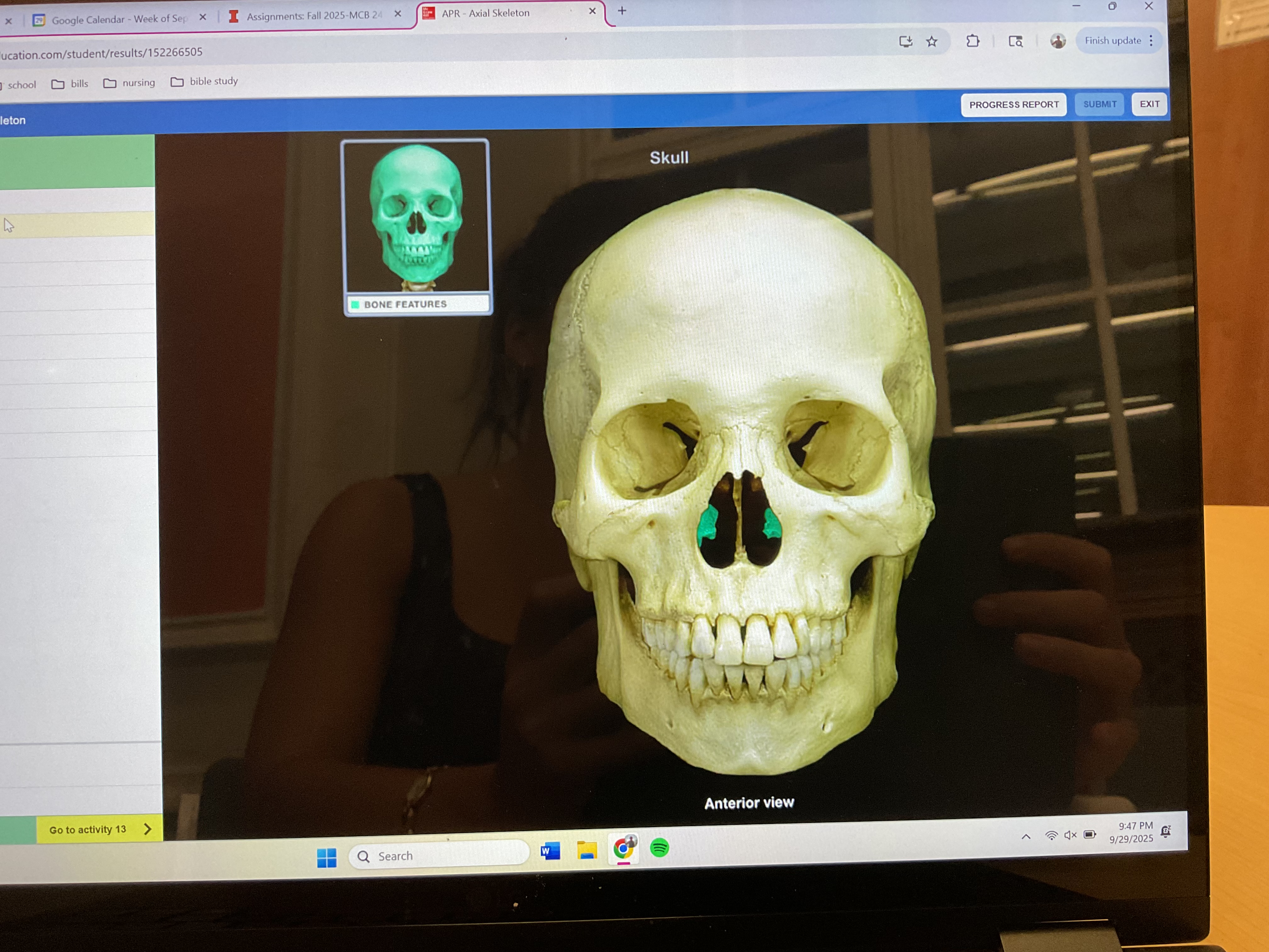 <p>Inferior nasal concha </p>