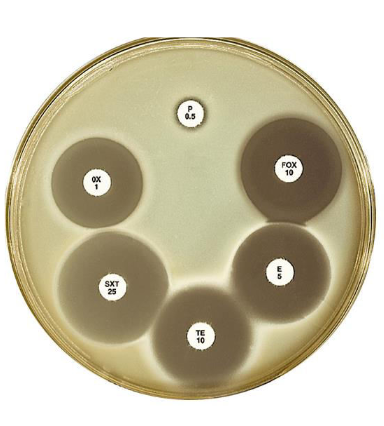 <p>What is measured to interpret the result of this test?</p>