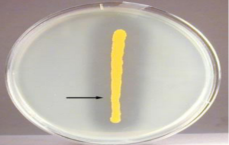 <p>identify the test ?</p><p>use ? </p><p>principle ? </p><p>method ?</p>