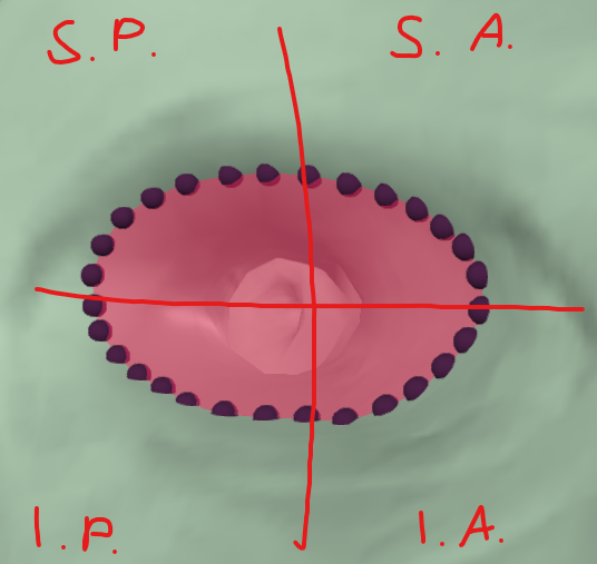 <p><strong>vnitřní zvukovod</strong></p><p>začíná v <strong>porus acusticus internus</strong></p><p>končí dnem <strong>fundus meatus acustici interni</strong></p><p>dno je rozděleno pomocí <strong>crista transversa </strong>na horní a dolní</p><p><strong>crista verticalis </strong>odděluje přední a zadní část</p><ul><li><p>sup. ante. - <strong>area n. facialis </strong>- průchod <strong><span style="color: yellow">n. facialis</span></strong></p></li><li><p>sup. post. - <strong>area vestibularis sup. </strong>- průchod <strong><span style="color: yellow">ultrikoampulární část n. vestibularis</span></strong></p></li><li><p>inf. ante. - <strong>area cochlearis - <span style="color: yellow">tractus spiralis foraminosus</span> </strong>pro vlákna <strong><span style="color: yellow">n. cochlearis</span></strong></p></li><li><p>inf. post. - <strong>area vestibularis inf. - </strong>průchod <strong><span style="color: yellow">sakulární část n. vestibularis</span></strong></p></li></ul>