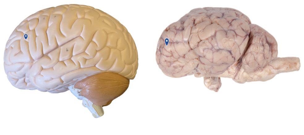 <p>What lobe is the arrow pointing to?</p>
