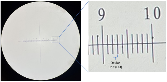 using the **ocular micrometer**