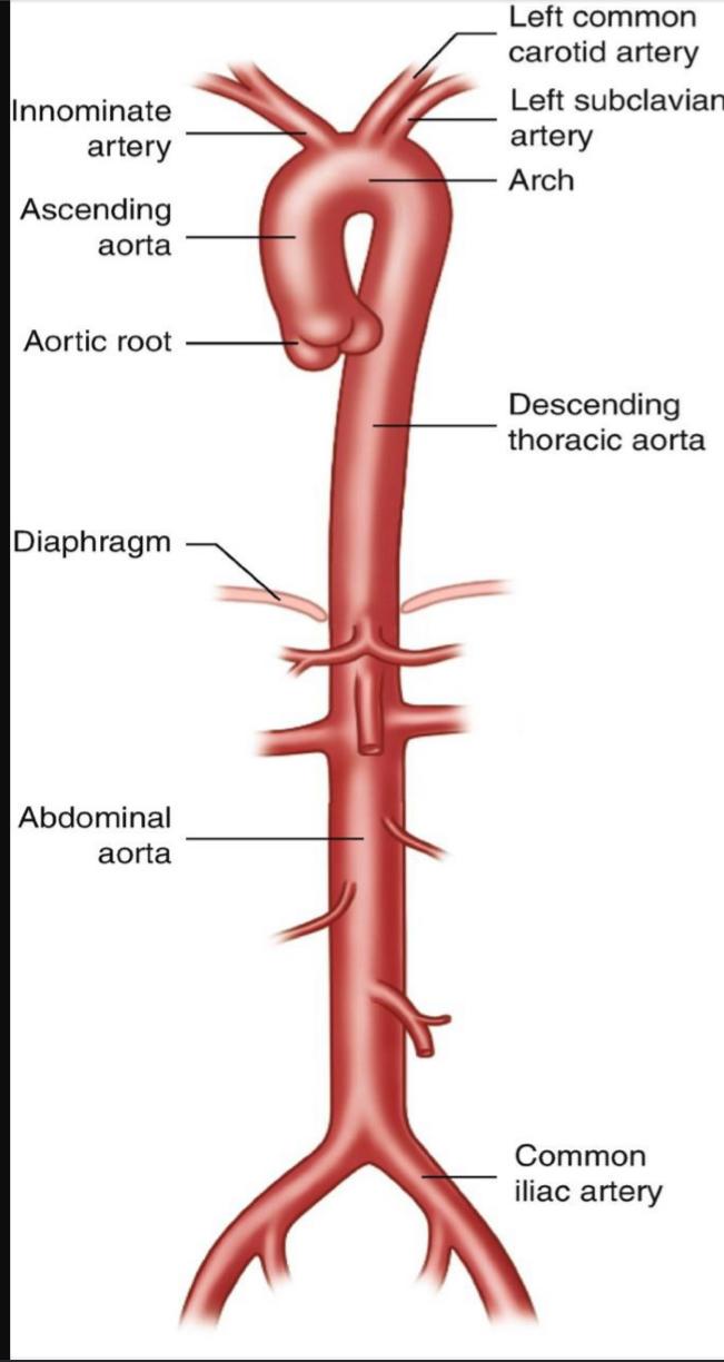 <p>Be able to identify all portions of the aorta including the branches</p>