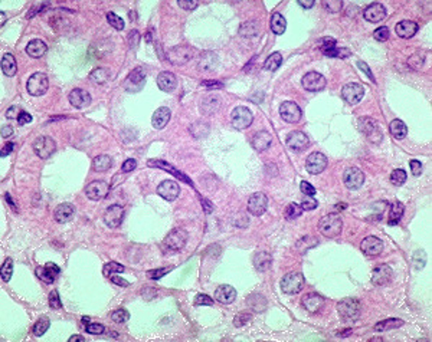 <p>Single layer of cubelike cells with large central nuclei, usually involved in secretion/absorption. - NO MODIFICATIONS</p>