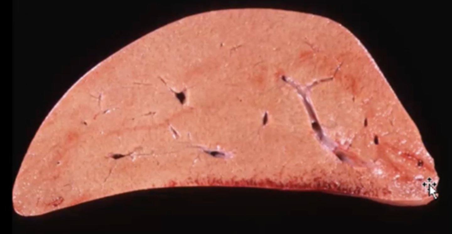 <p>Pony liver: What caused this gross appearance?</p>