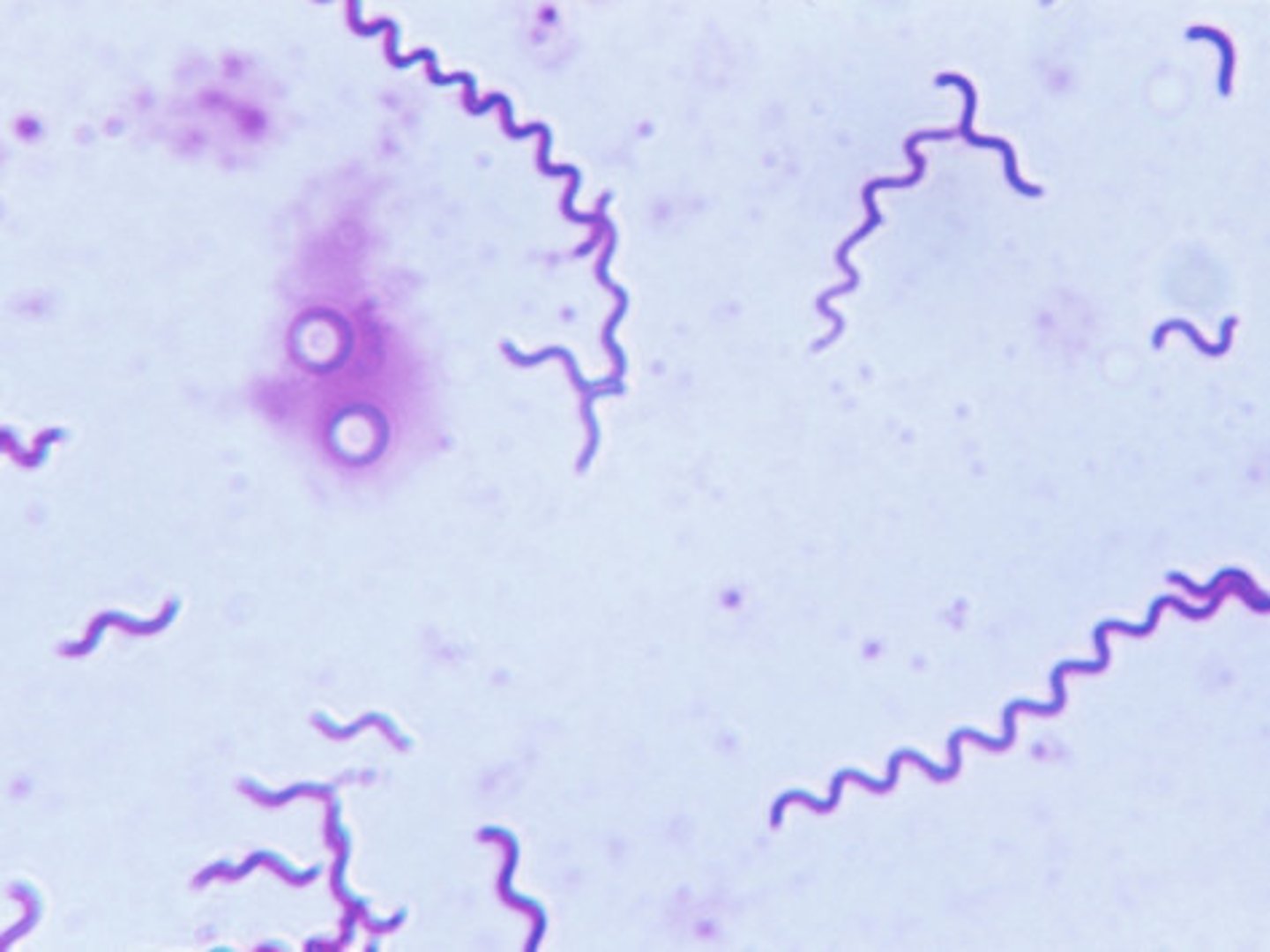 <p>spiral-shaped bacteria that have flexible walls and are capable of movement</p>