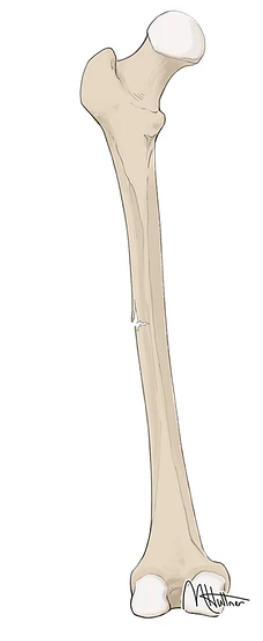 Bone is partially cracked, but still attached

