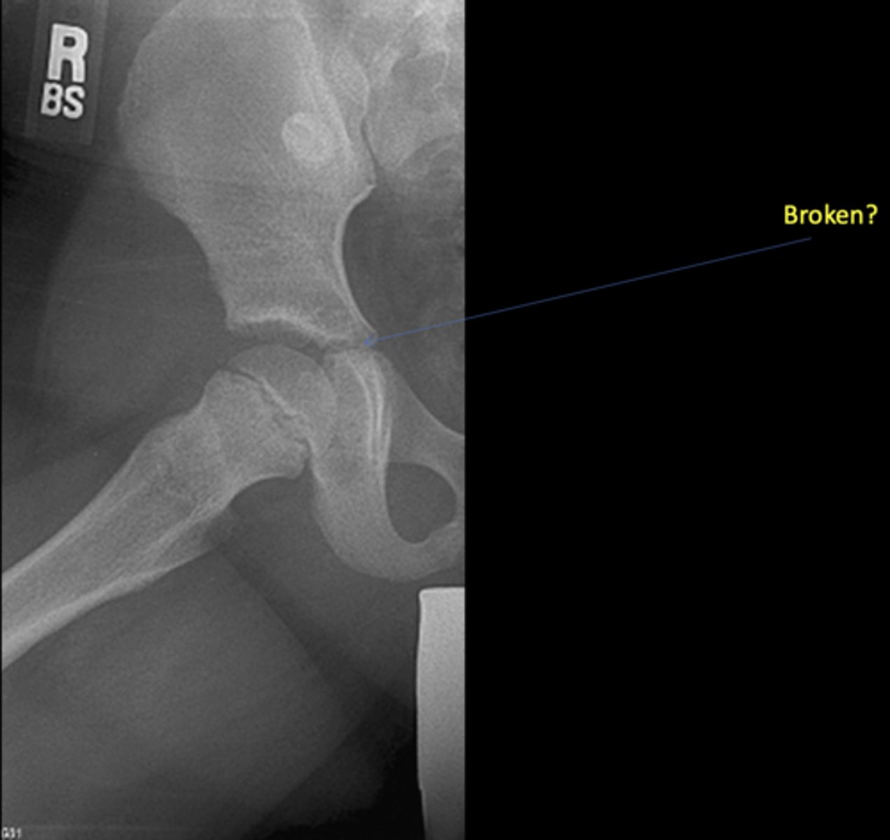 <p>Broken?</p>