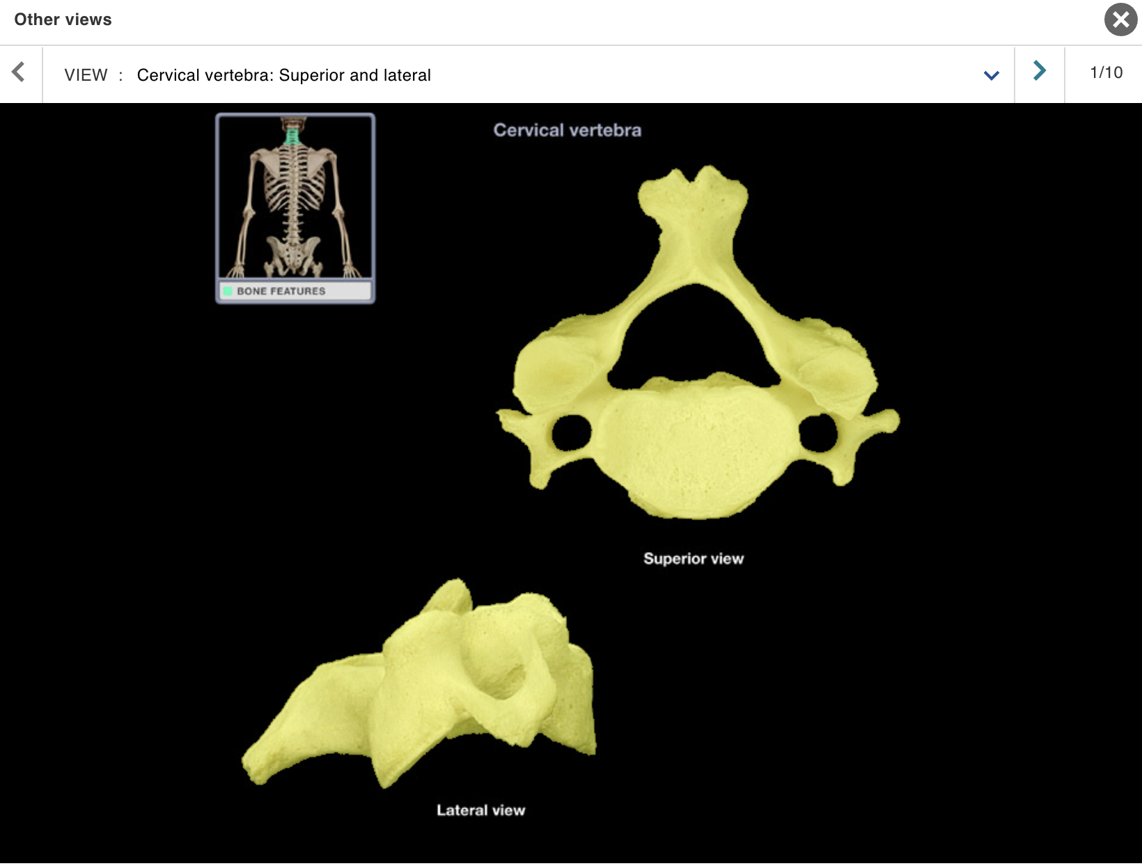 <p>Location:</p><ul><li><p>﻿﻿Neck</p></li><li><p>﻿﻿Between occipital bone and T1 vertebra</p></li></ul><p class="p1">Description:</p><ul><li><p>﻿﻿Seven individual vertebrae</p></li><li><p>﻿﻿Characteristic features include transverse foramen and bifid<br>(split) spinous process on C3-C6</p></li></ul><p class="p1">Comment:</p><p class="p1">• Atlas (C1 vertebra) articulates with skull</p>