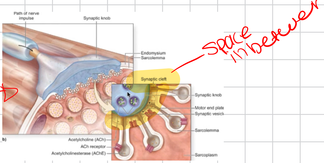 <p>Synaptic knob of motor neuron, synaptic cleft, and motor end plate</p>