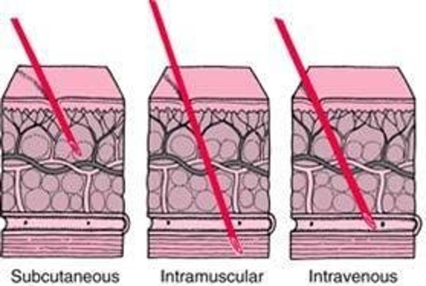 <p>Routes that bypass the GI tract such as IV IA IM and SC.</p>