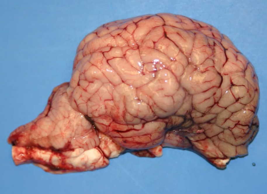 <p>The etiology is deficiency of what?</p><p>A-Selenium</p><p>B-Vitamin D</p><p>C-Vitamin A</p><p>D-Copper</p>