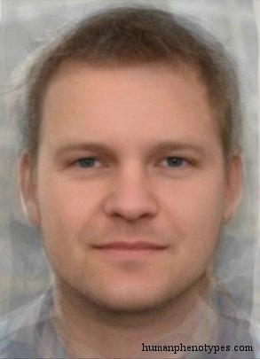 <p>Identify this Phenotype</p>