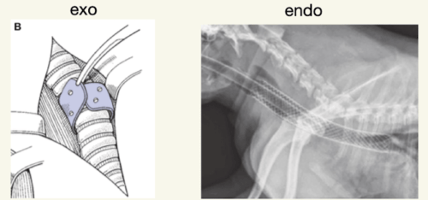 <p>colocar un exoprótesis o endoprótesis</p>