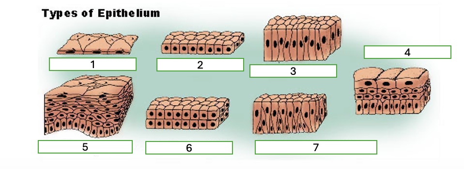<p>type 4 of epithelium</p>