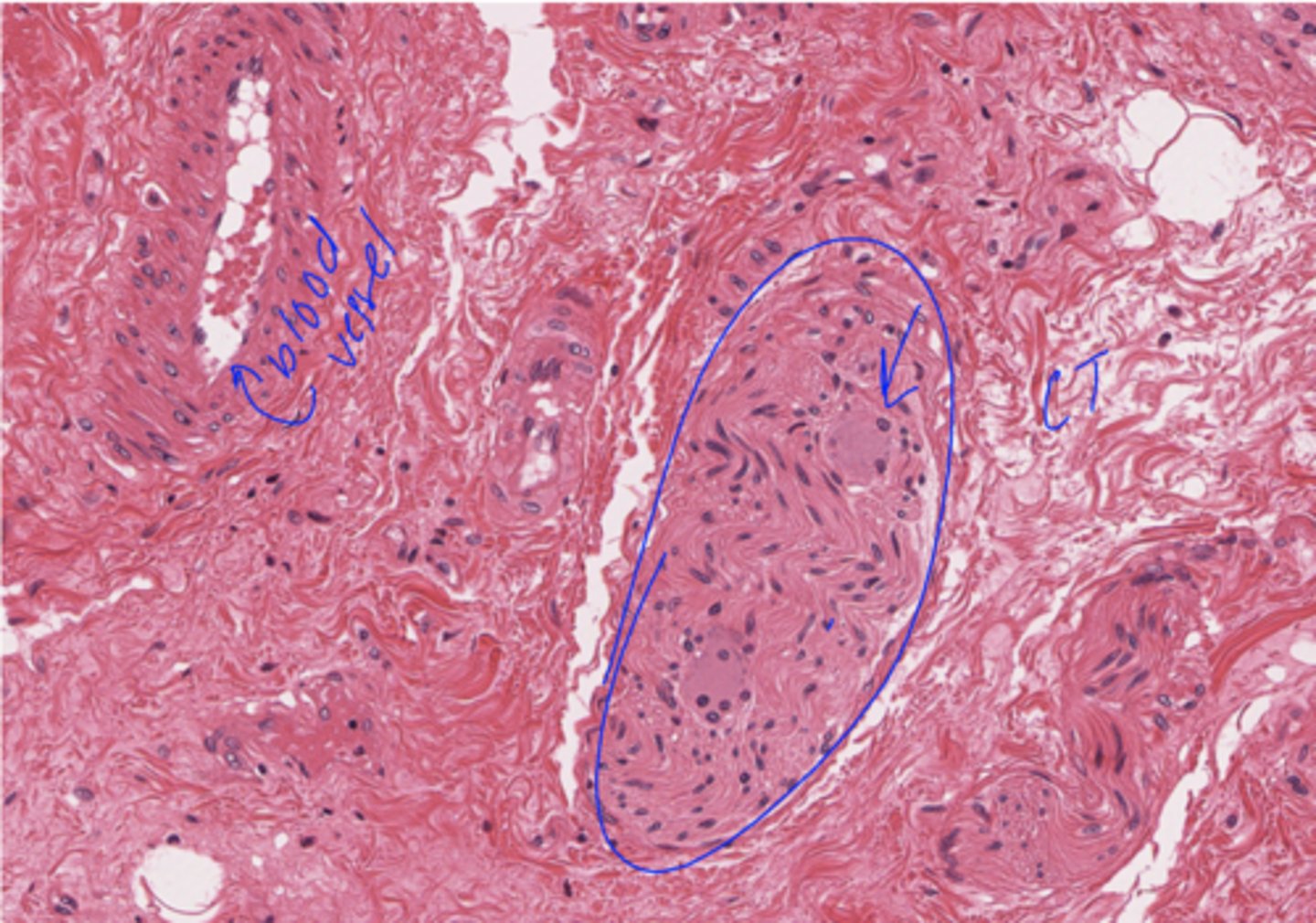 <p>Identify the organ of the PNS (BLUE CIRCLE)</p>