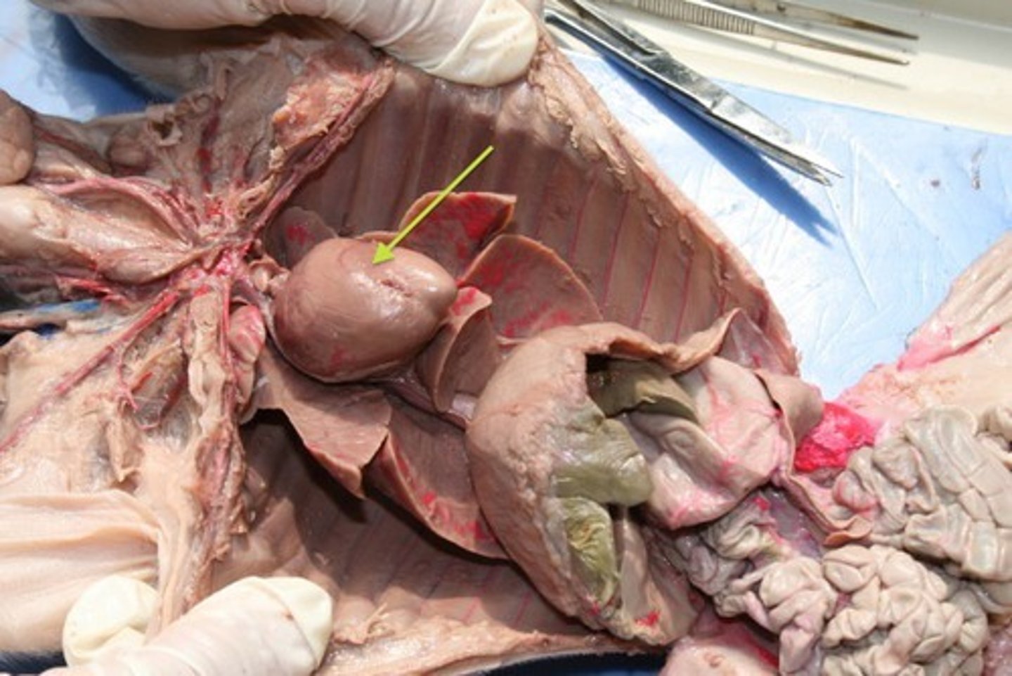 <p>What system does the Heart belong to.</p>