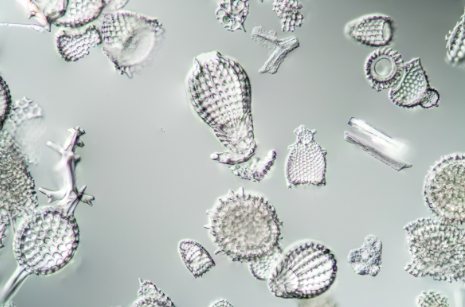 <p><span>unicellular predatory protists, covered in elaborate shells usually made of silica and perforated with holes in a variety of patterns, forming a series either of lacy plates or needle-shaped spikes</span></p>