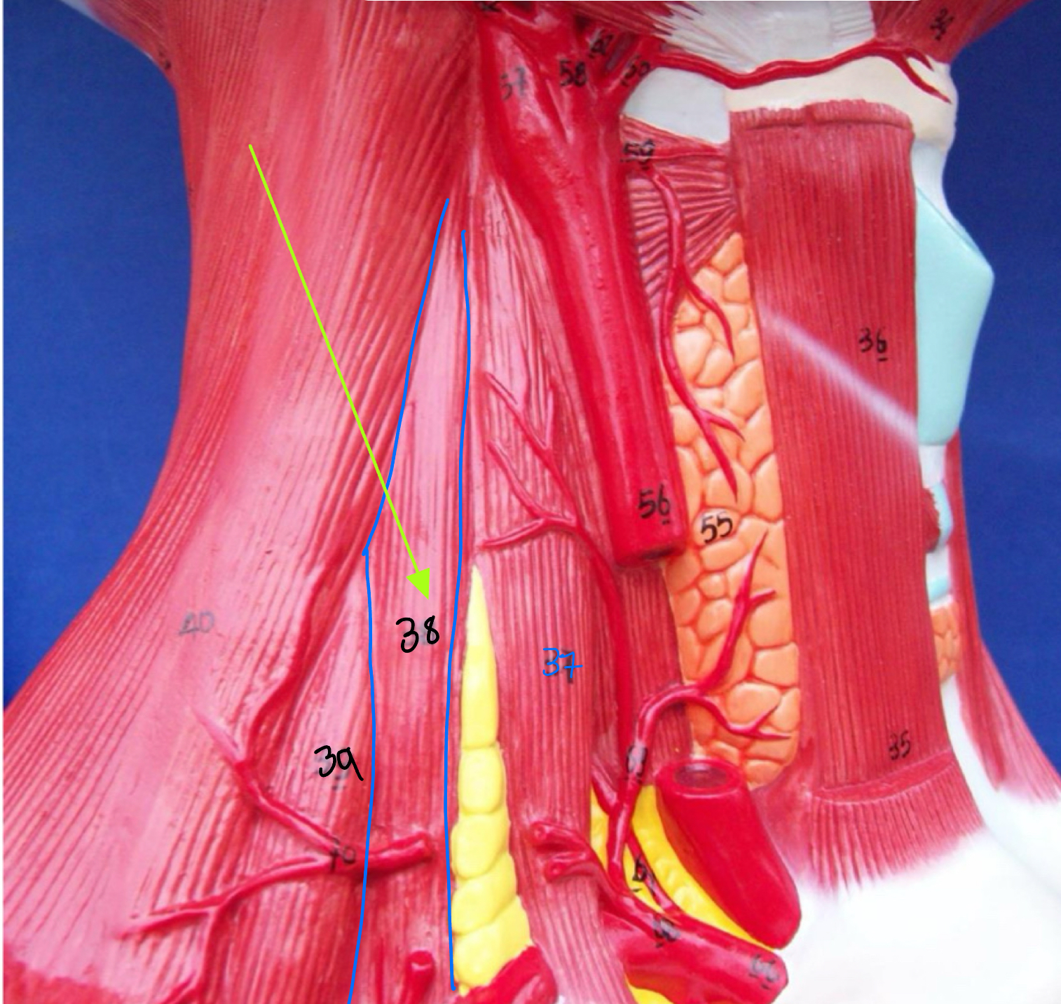 <p>What type of muscle is this ( altay model)</p>